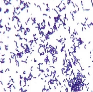 Gram positive